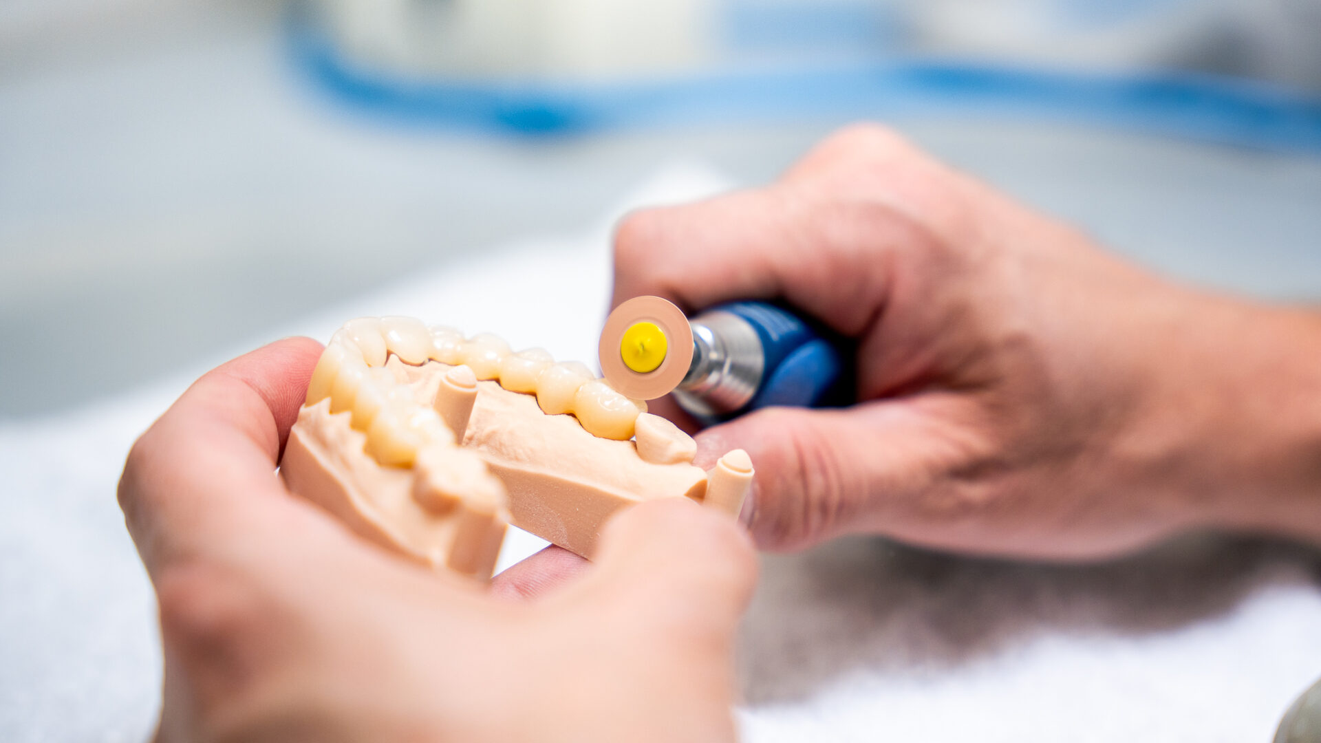 Smart Dentals - 3W - LR-16 Smart Dentals - 3W - LR-16