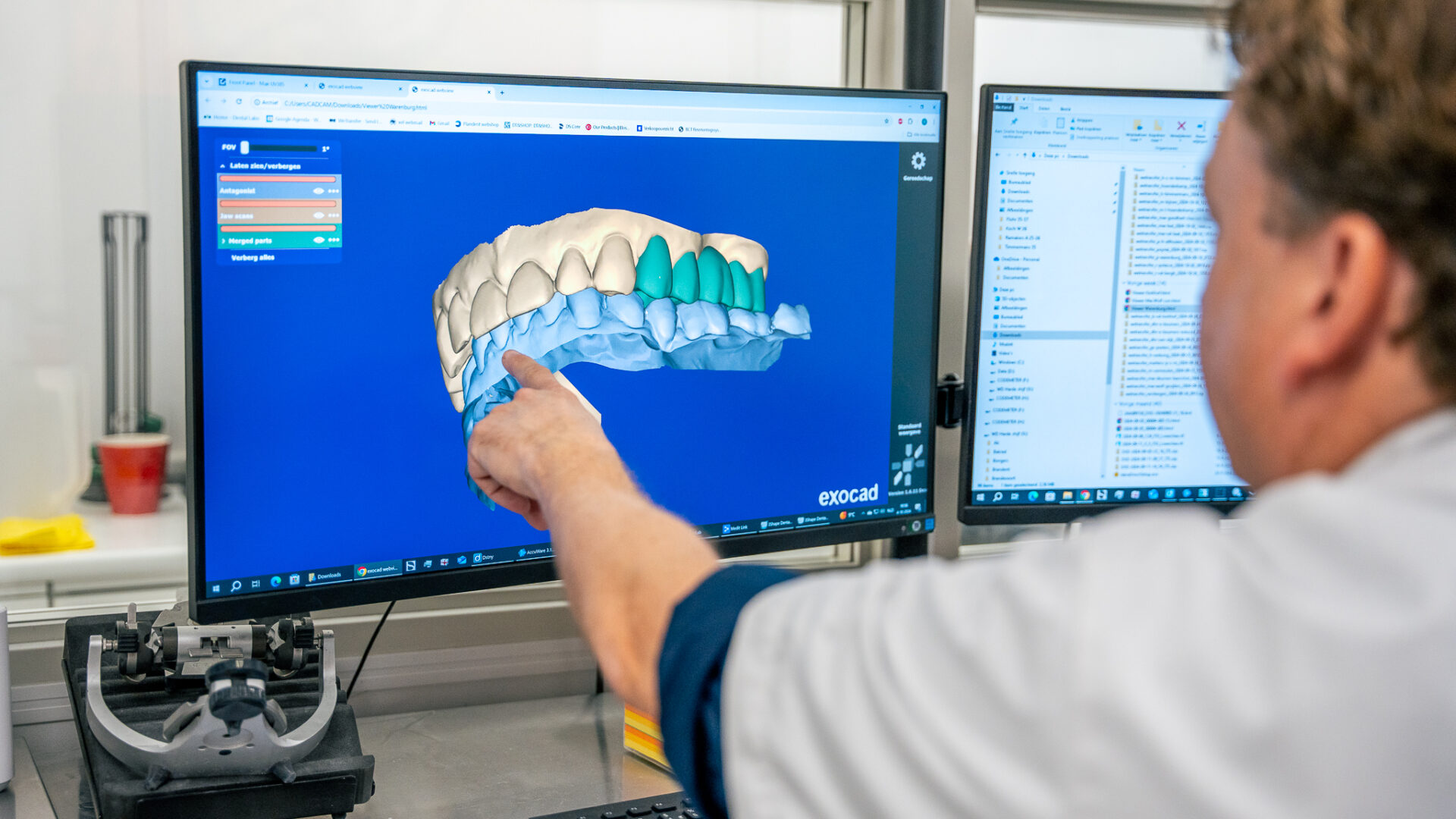 Smart Dentals - 3W - LR-33